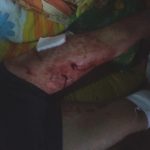 Bărbat atacat de urs la Boroşneu