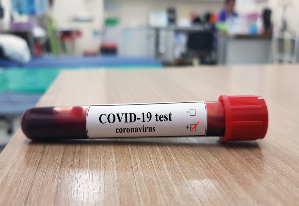 Coronavirus România: 277 de cazuri confirmate! 25 de persoane sunt declarate vindecate