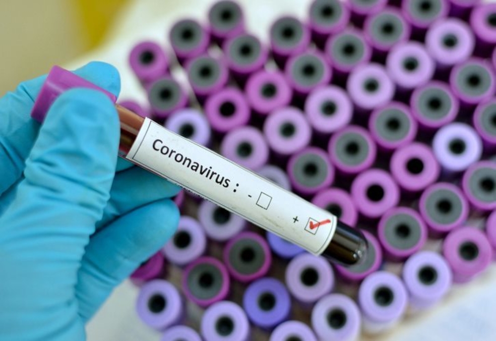 Al 6-lea deces din cauza coronaviruslui în România. Este primul deces din vestul țării