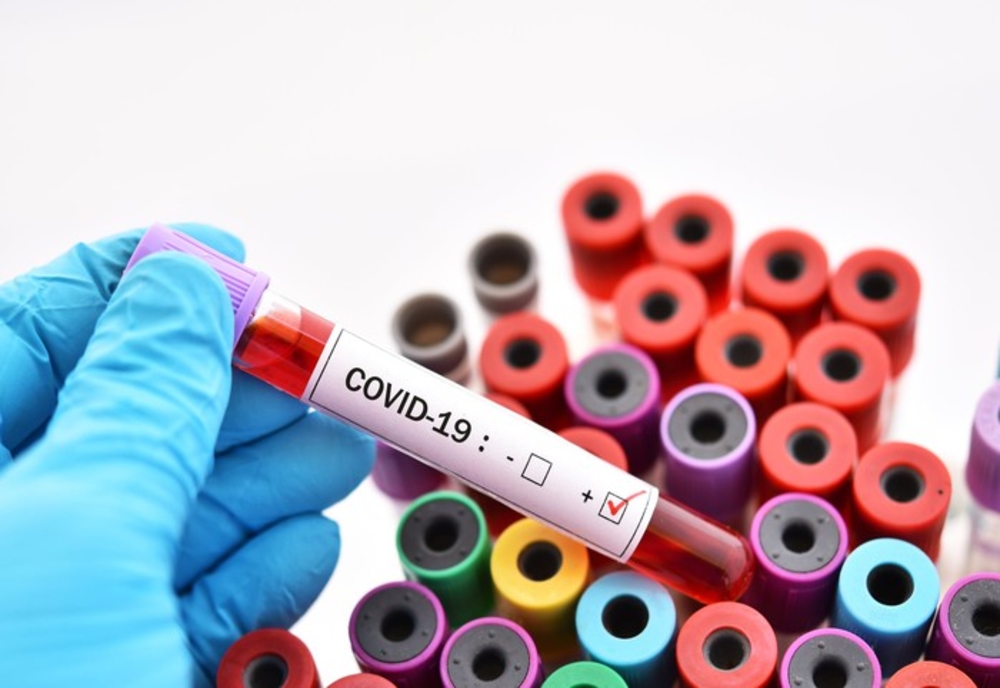 Test pozitiv la coronavirus în cazul bărbatului din Olt care este internat la Craiova