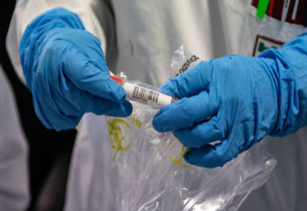 Încă 3 decese ale unor persoane infectate cu noul coronavirus. Numărul total a ajuns la 29