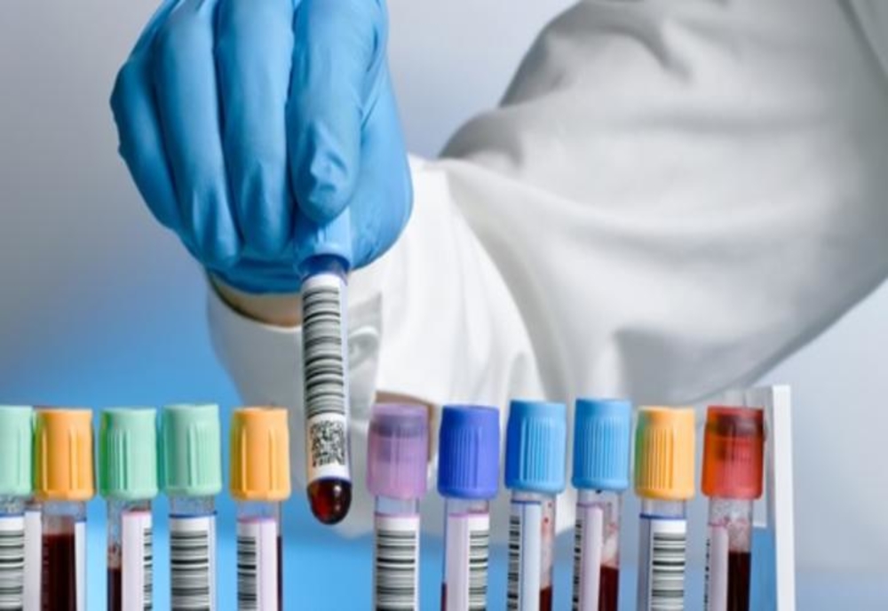 Spitalul Județean Arad face teste la cerere, contra-cost, pentru noul coronavirus. Cât costă