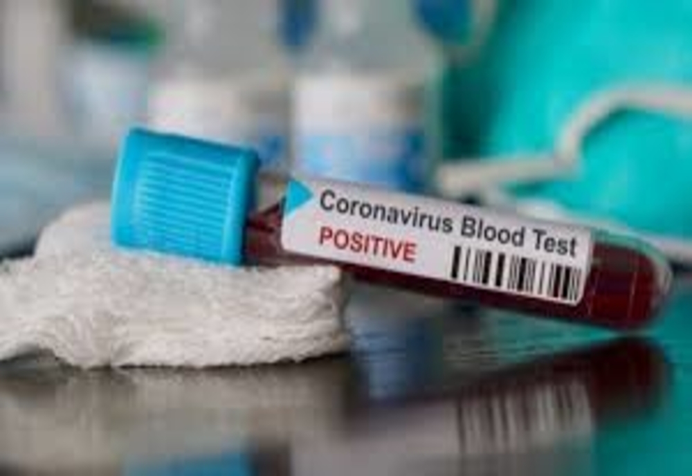 Autoritățile au anunțat cu puțin timp în urmă noi decese în România, ca urmare a infecției cu coronavirus. Bilanțul deceselor în România – 203