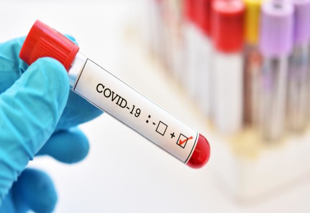 COVID-19 | Peste 3.000 de teste efectuate și 2.914 persoane testate