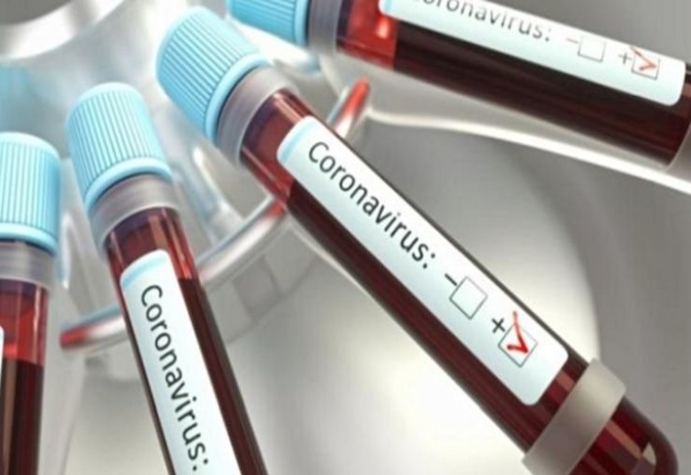 Coronavirus într-o comună din nordul judeţului. O femeie a fost internată la un spital din Vâlcea