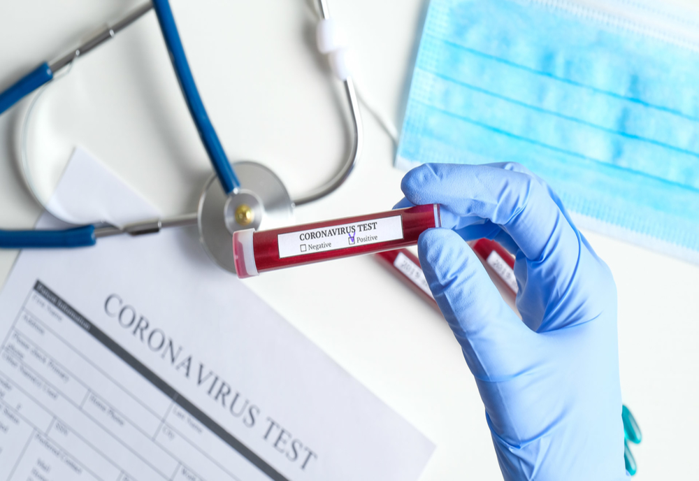 Jumătate din testele COVID-19 efectuate la Spitalul Municipal Hunedoara sunt la cerere