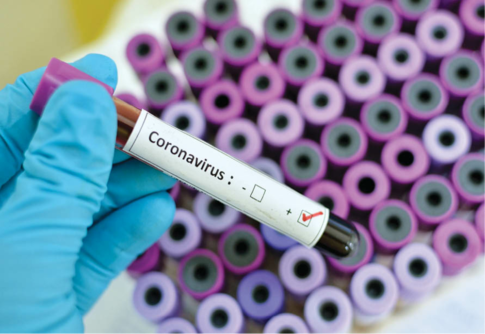 Coronavirus la APIA Olt. Un angajat, testat pozitiv
