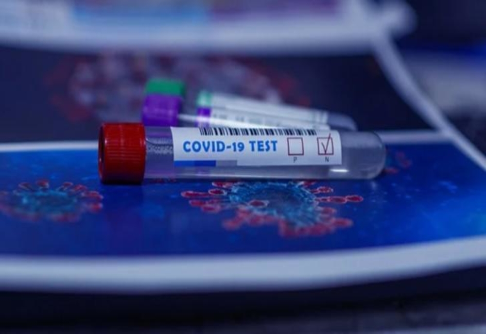 COVID-19. 3.240 de noi cazuri, în ultimele 24 de ore, din doar 11.445 de teste (28,3%)! 130 de pacienți au decedat!