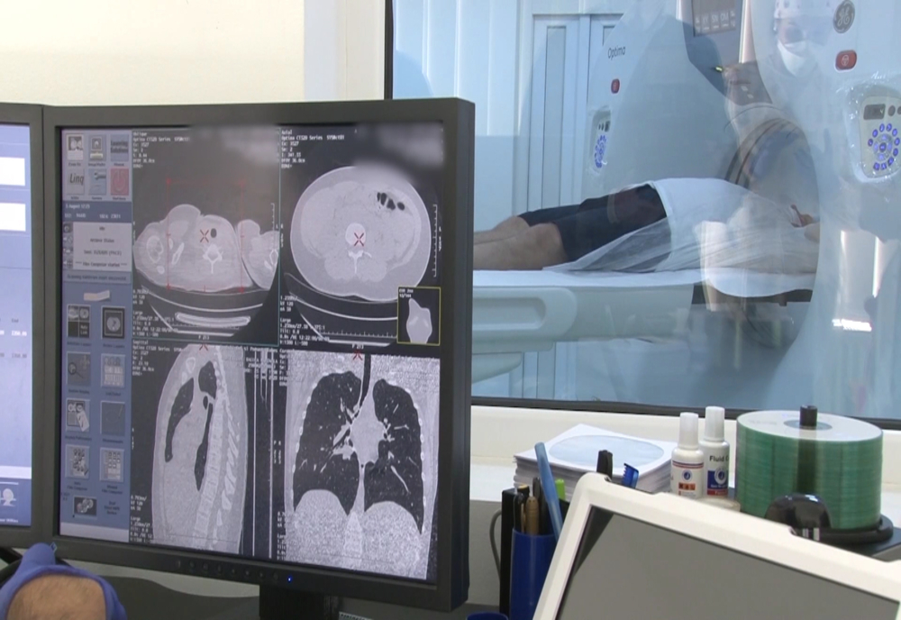 Spitalul de Boli Infecțioase  Victor Babeș nu mai poate realiza investigații imagistice de tip CT persoanelor infectate cu SARS Cov 2