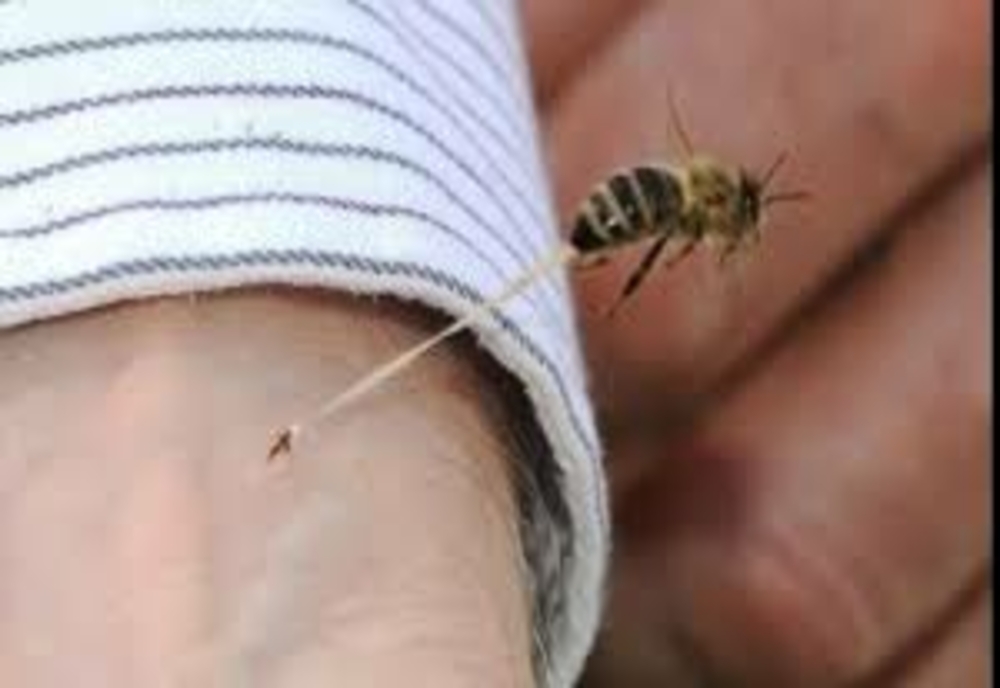 Ce faci dacă te înţeapă o albină. 10 lucruri care vă pot salva viața.