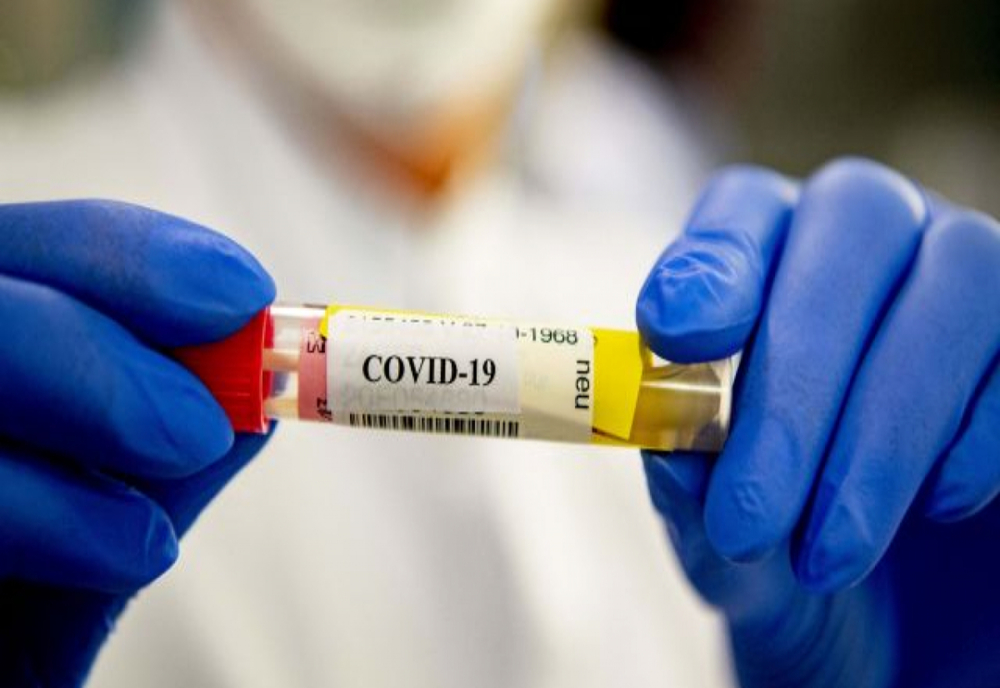 Au fost înregistrate 58 cazuri noi de persoane infectate cu SARS – CoV – 2