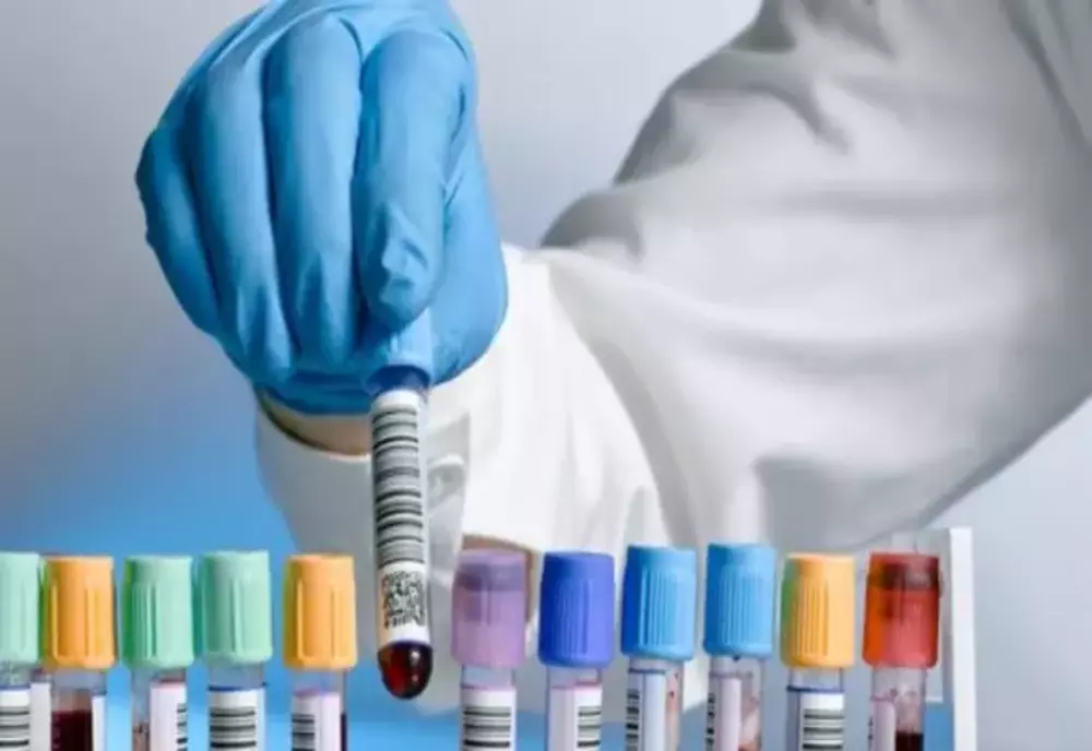 Cel mai mare studiu clinic al unui test de sânge care poate detectat 50 de tipuri de cancer, demarat în Marea Britanie