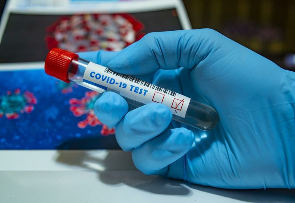 Bilanț coronavirus: Peste 1.400 de infectări și 107 decese în ultimele 24 de ore