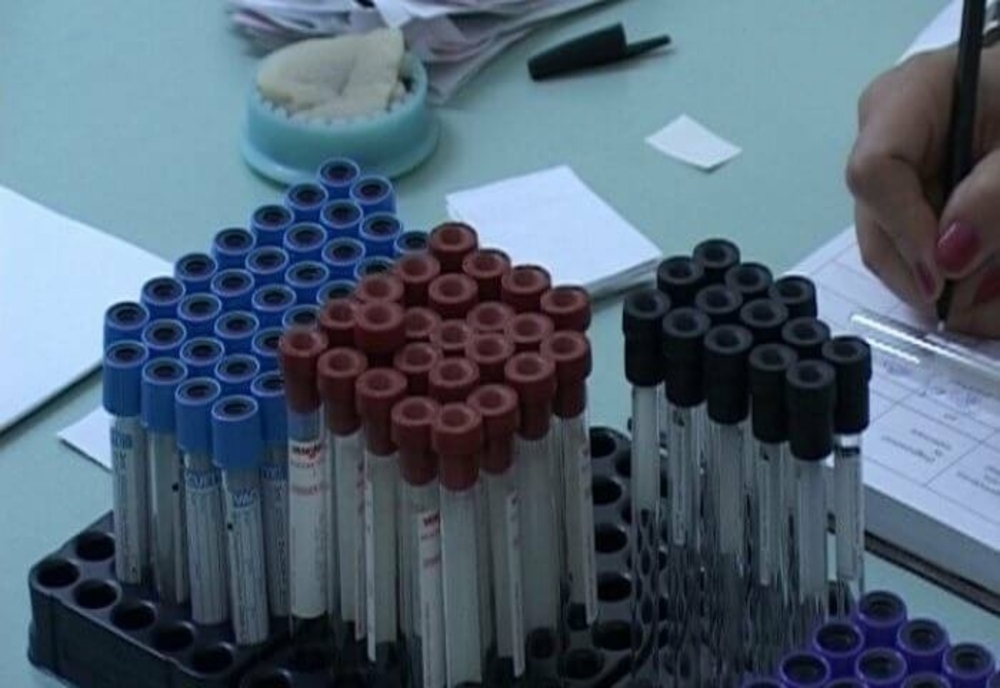 Campanie de testare gratuită, pentru depistarea hepatitelor virale, în Dâmboviţa