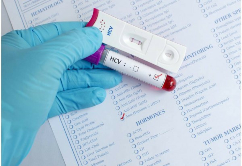 Reșița: Campanie de testare gratuită pentru depistarea virusului hepatic