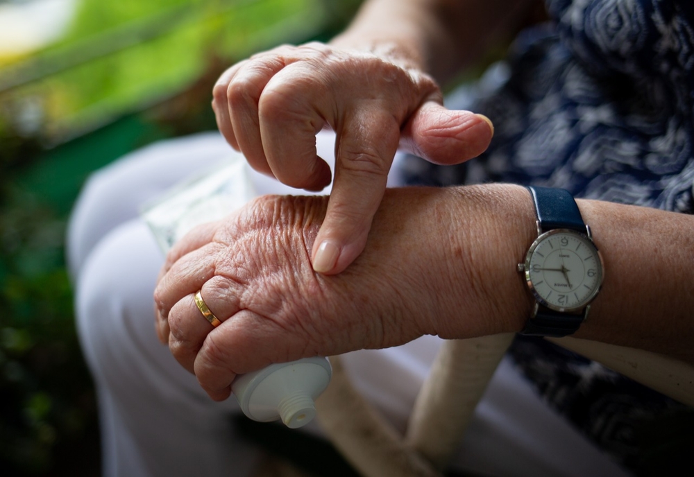 Totul despre artrită: Tipuri, diagnostic și tratament