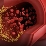 Cum contribuie stresul la creșterea colesterolului?