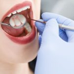 Lista servicilor stomatologice decontate pentru români a fost suplimentată – tratamentele decontate de CNAS